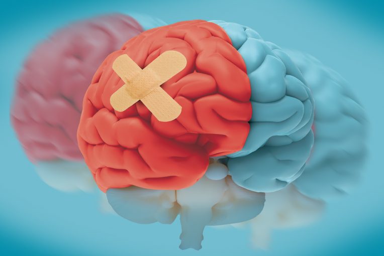 红雀学者封面图片显示模型大脑半红半蓝色和红色一边用创可贴